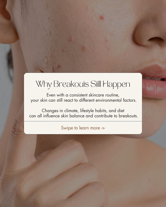 acne breakouts on skin and causes of blemishes explained in skincare education